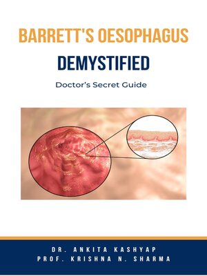 cover image of Barretts Oesophagus Demystified